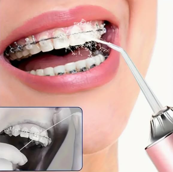 Hydropulseur dentaire (livraison gratuite)